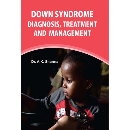 Down Syndrome: Diagnosis, Treatment And Management