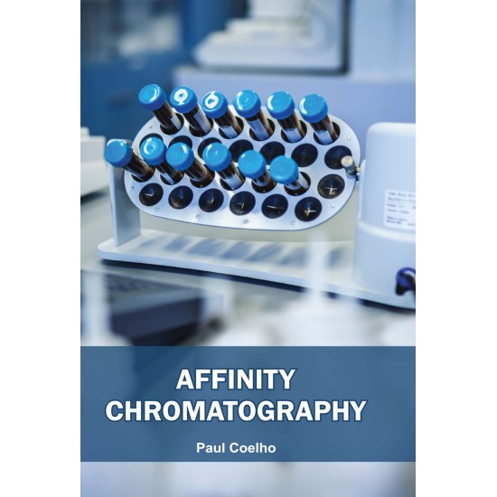 Affinity Chromatography