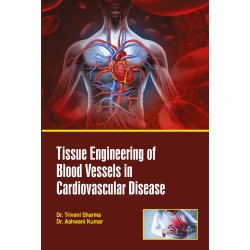 Tissue Engineering of Blood Vessels in Cardiovascular Disease