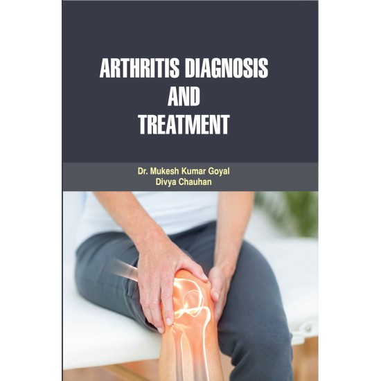 Arthritis Diagnosis and Treatment 